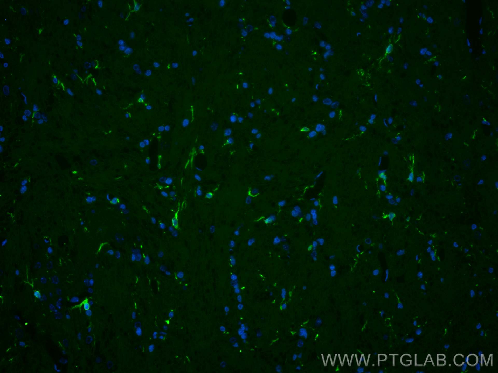 IF Staining of rat brain using CL488-10904