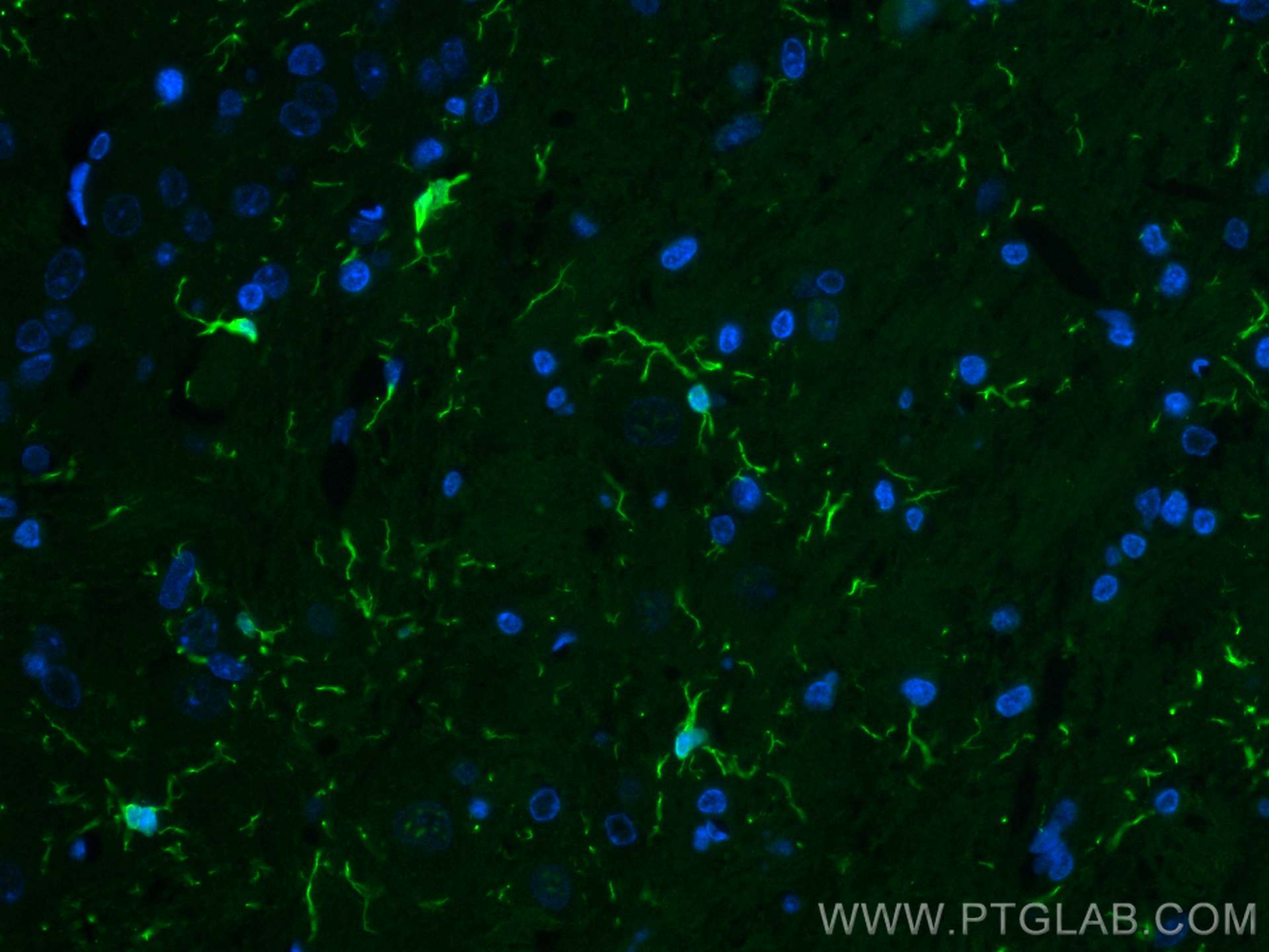 Immunofluorescence (IF) / fluorescent staining of rat brain tissue using CoraLite® Plus 488-conjugated IBA1 Polyclonal anti (CL488-10904)
