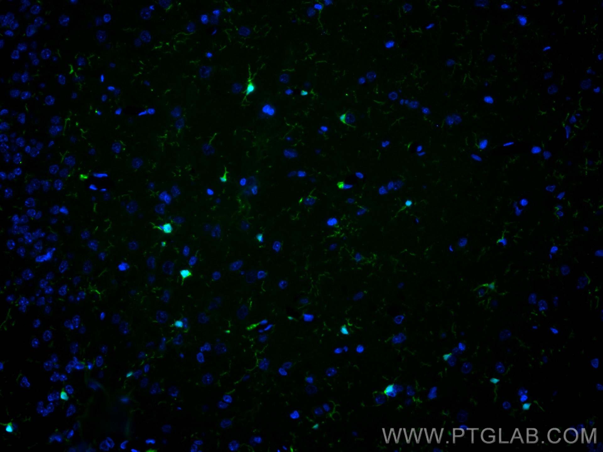 Immunofluorescence (IF) / fluorescent staining of rat brain tissue using CoraLite® Plus 488-conjugated IBA1 Recombinant ant (CL488-81728)