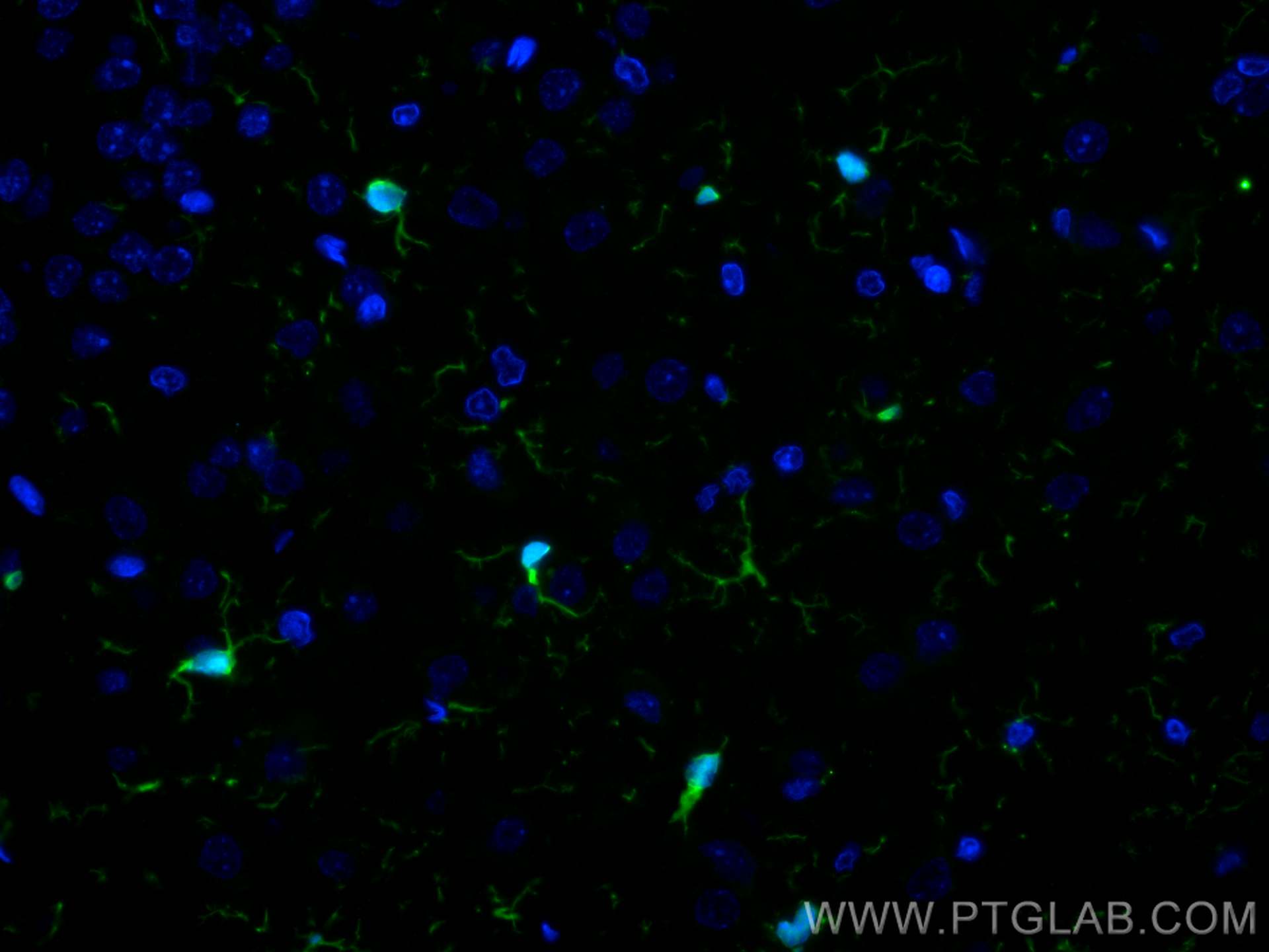 Immunofluorescence (IF) / fluorescent staining of rat brain tissue using CoraLite® Plus 488-conjugated IBA1 Recombinant ant (CL488-81728)