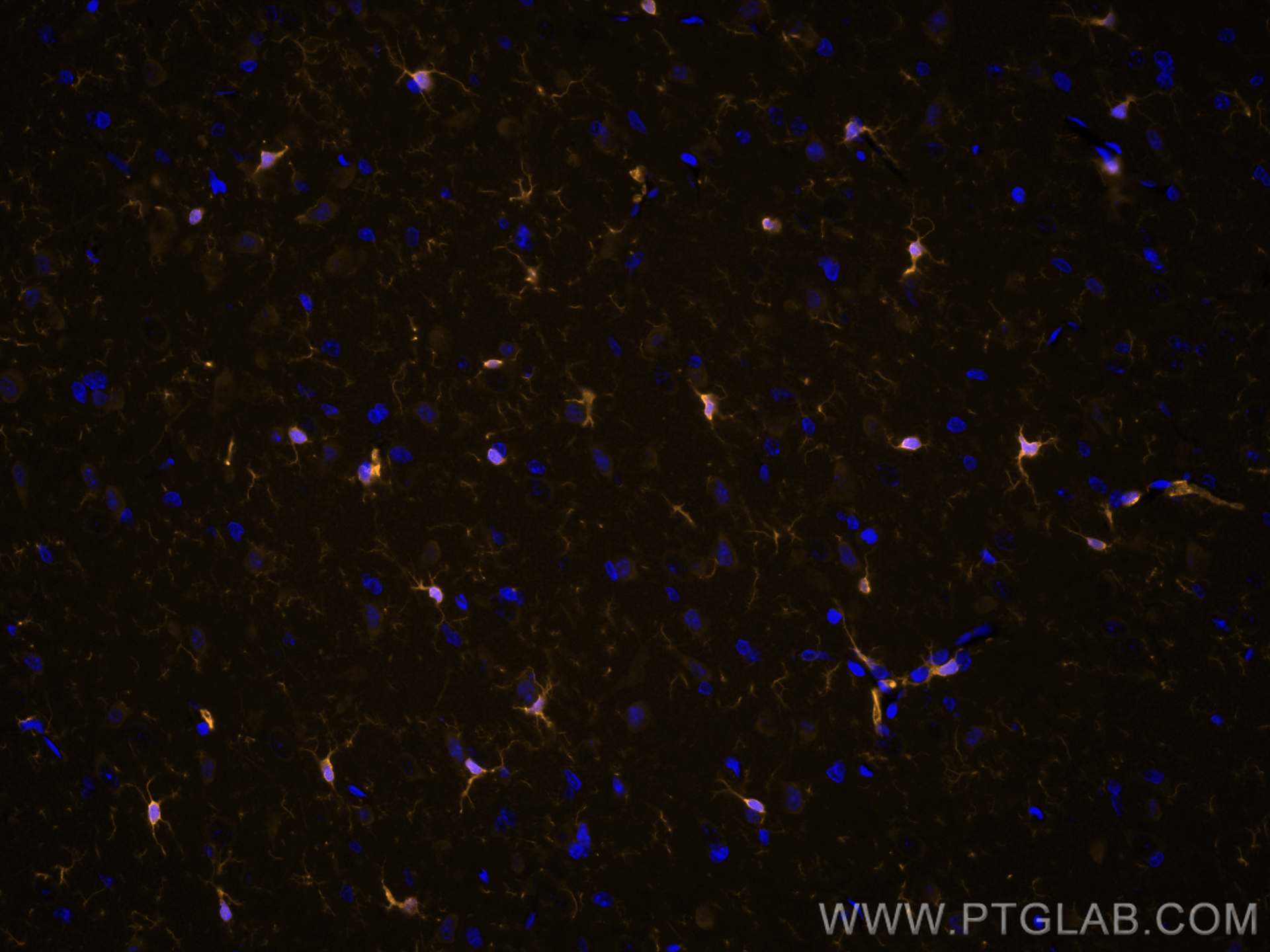 Immunofluorescence (IF) / fluorescent staining of rat brain tissue using CoraLite®555-conjugated IBA1 Recombinant antibody (CL555-81728)