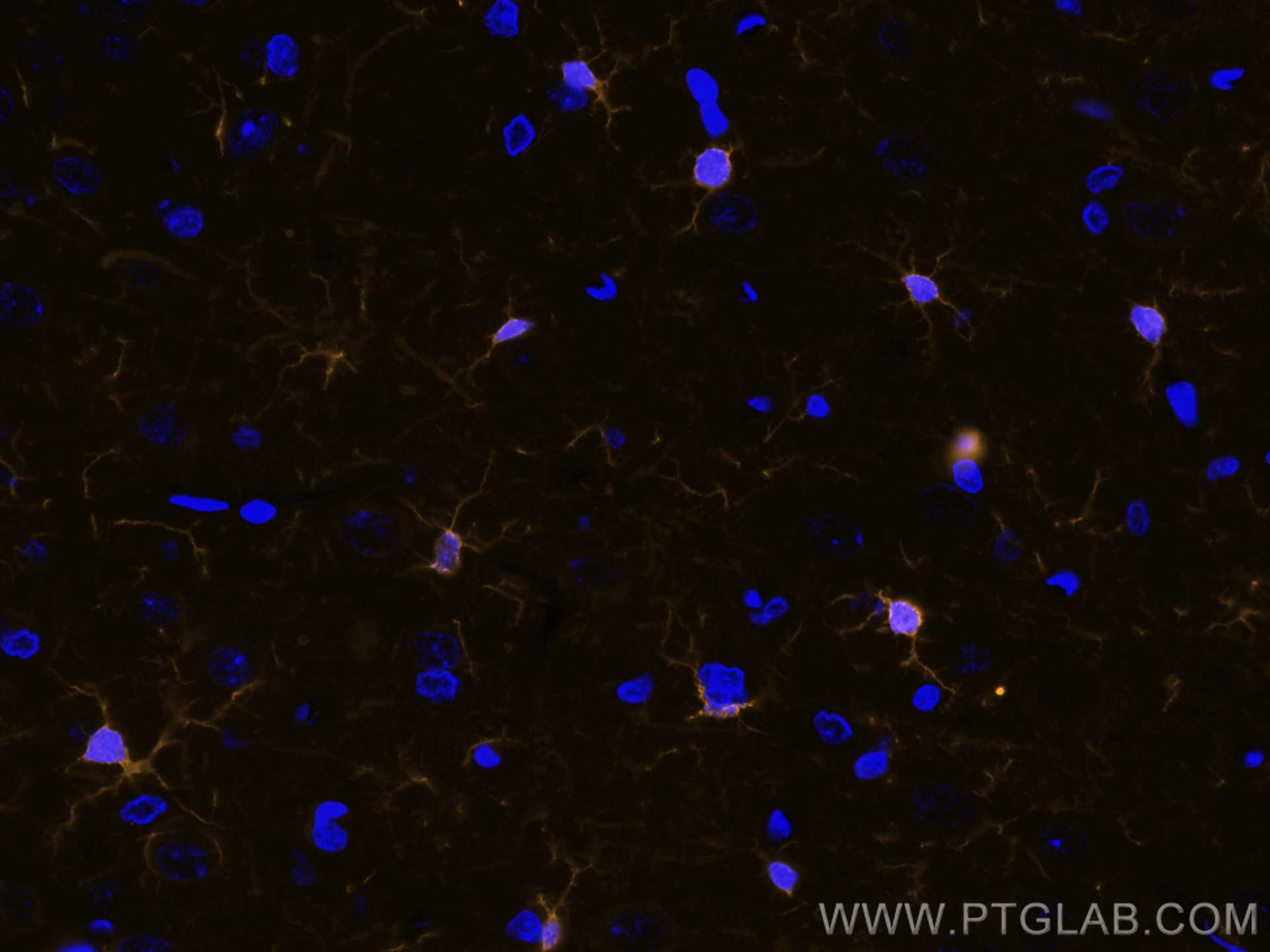 Immunofluorescence (IF) / fluorescent staining of rat brain tissue using CoraLite®555-conjugated IBA1 Recombinant antibody (CL555-81728)