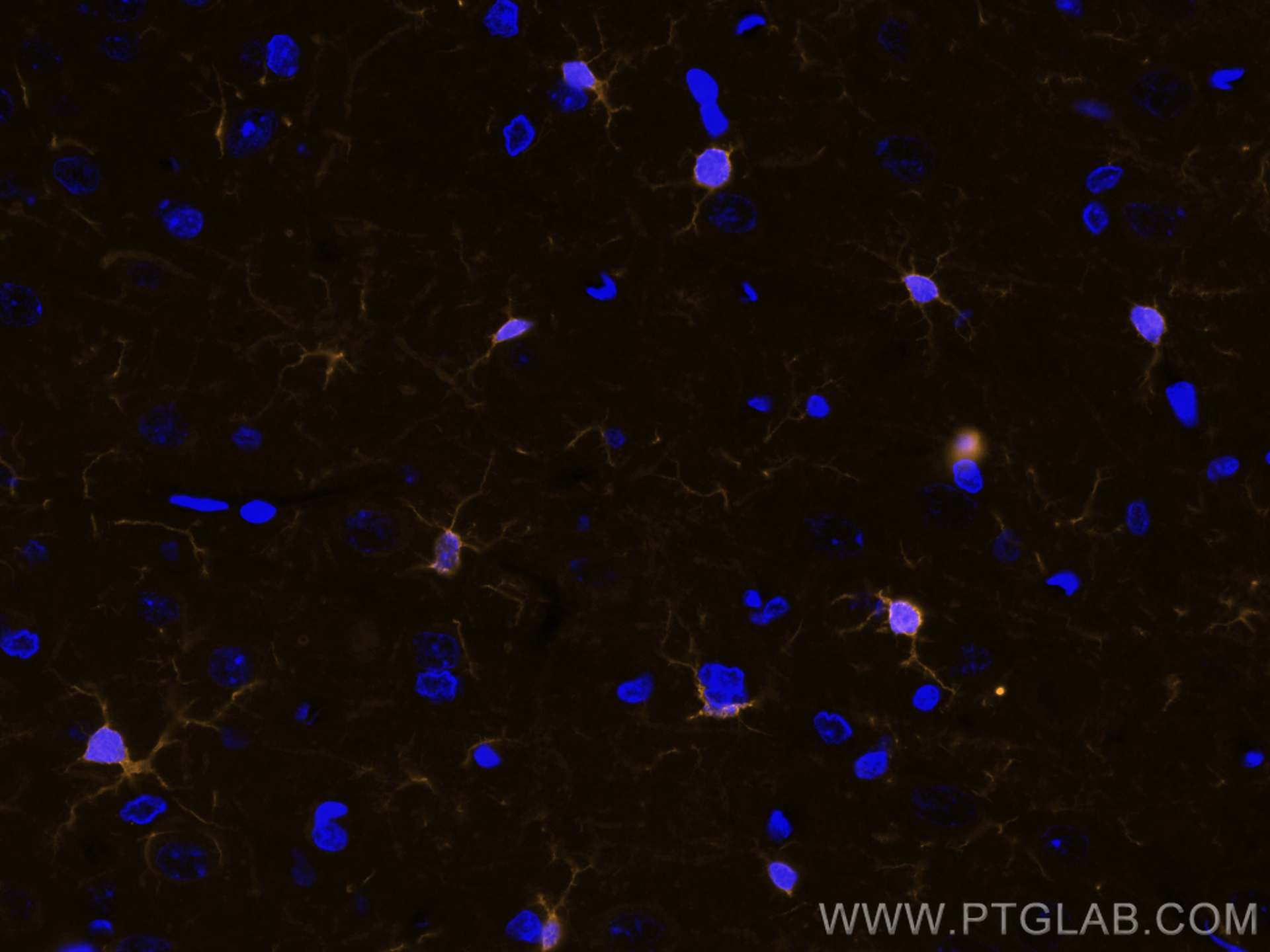 IF Staining of rat brain using CL555-81728