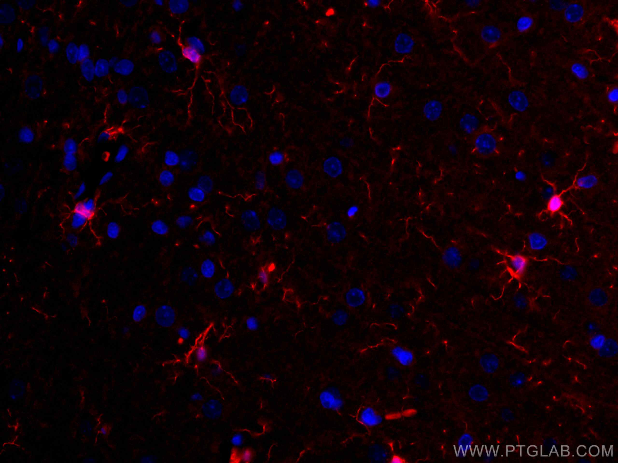 IF Staining of rat brain using CL594-10904