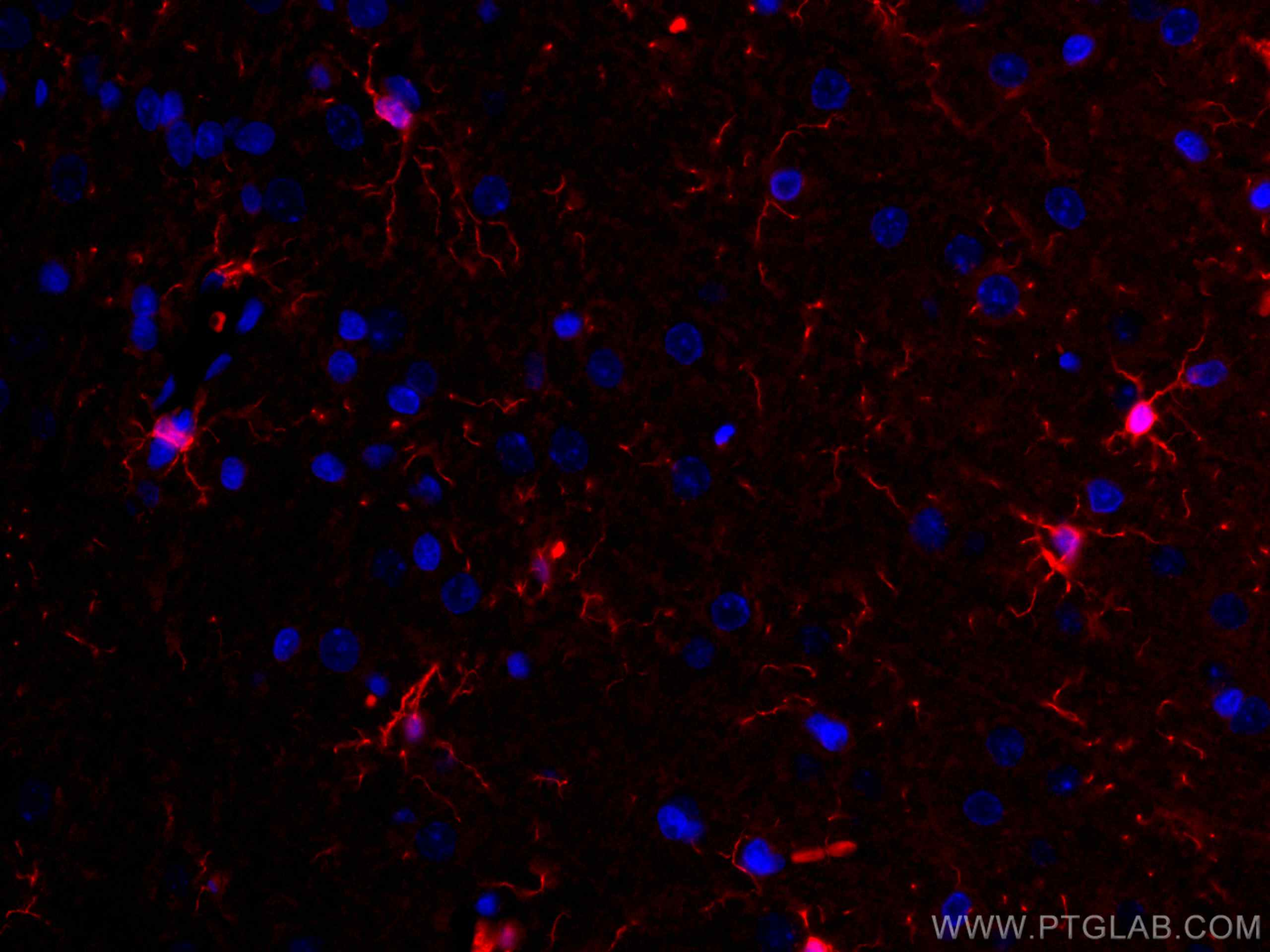 Immunofluorescence (IF) / fluorescent staining of rat brain tissue using CoraLite®594-conjugated IBA1 Polyclonal antibody (CL594-10904)