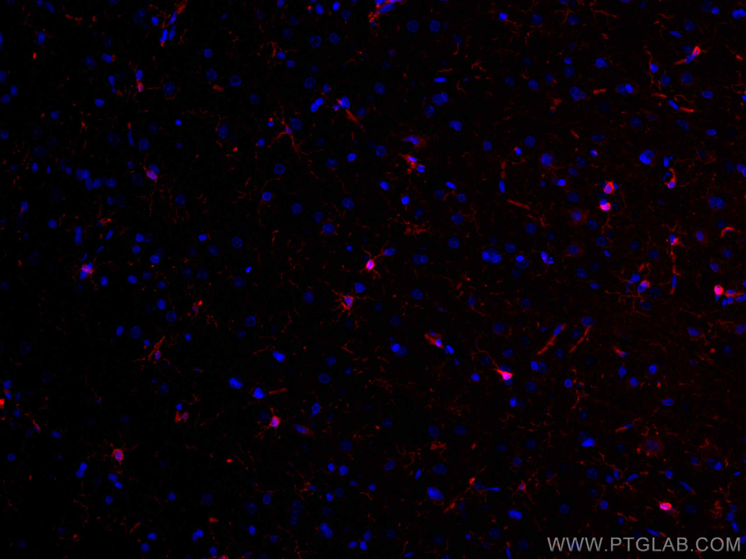 Immunofluorescence (IF) / fluorescent staining of rat brain tissue using CoraLite®594-conjugated IBA1 Polyclonal antibody (CL594-10904)