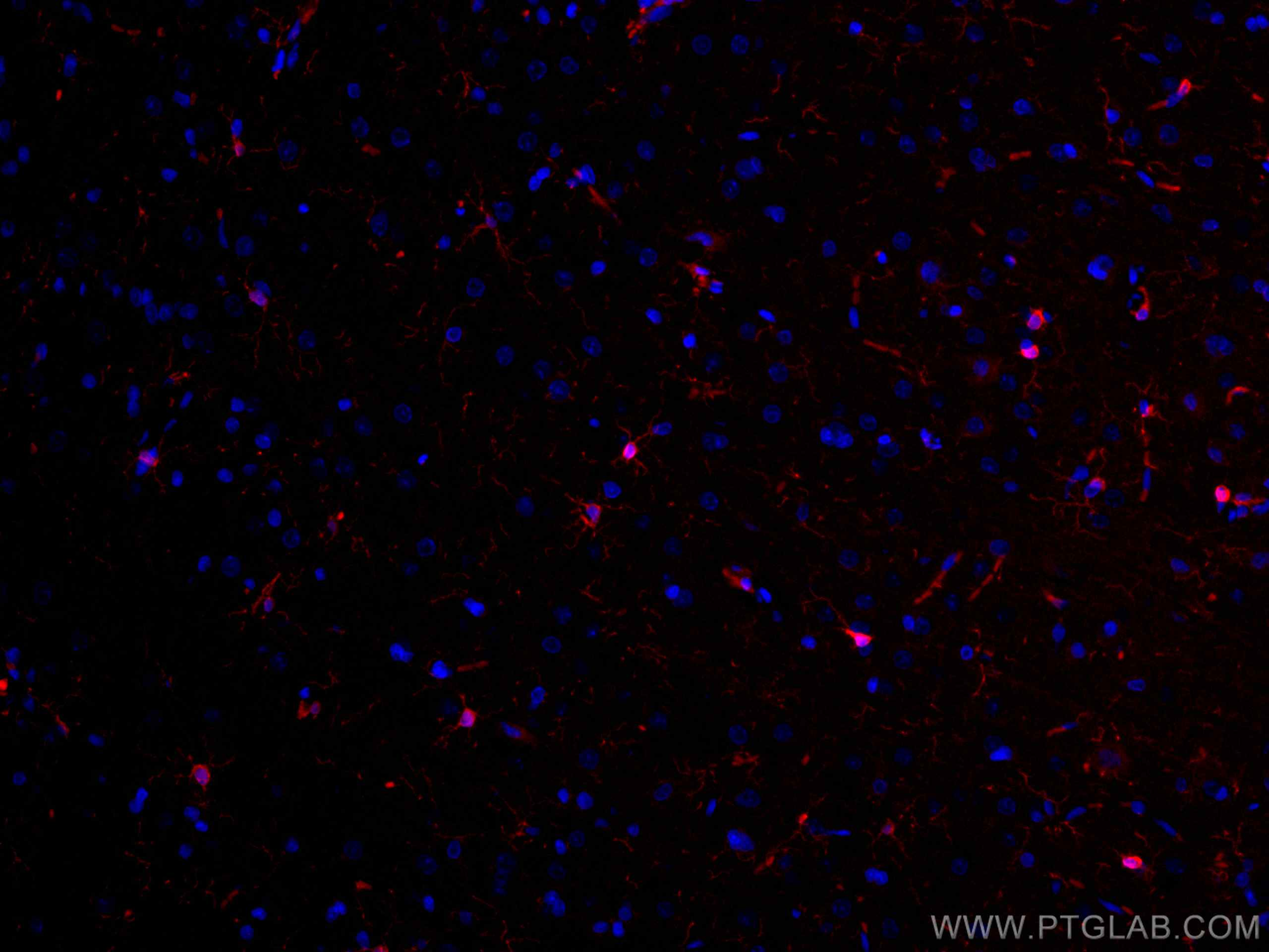 IF Staining of rat brain using CL594-10904