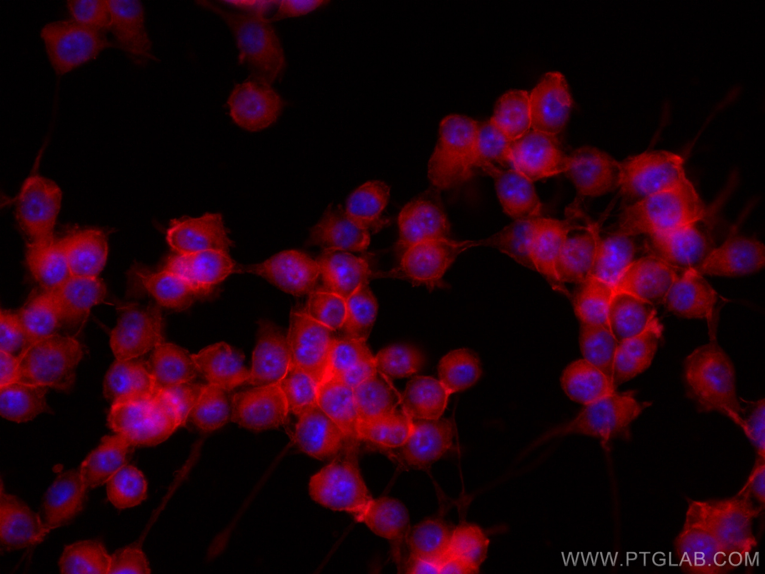 Immunofluorescence (IF) / fluorescent staining of BV-2 cells using CoraLite®594-conjugated IBA1 Polyclonal antibody (CL594-10904)