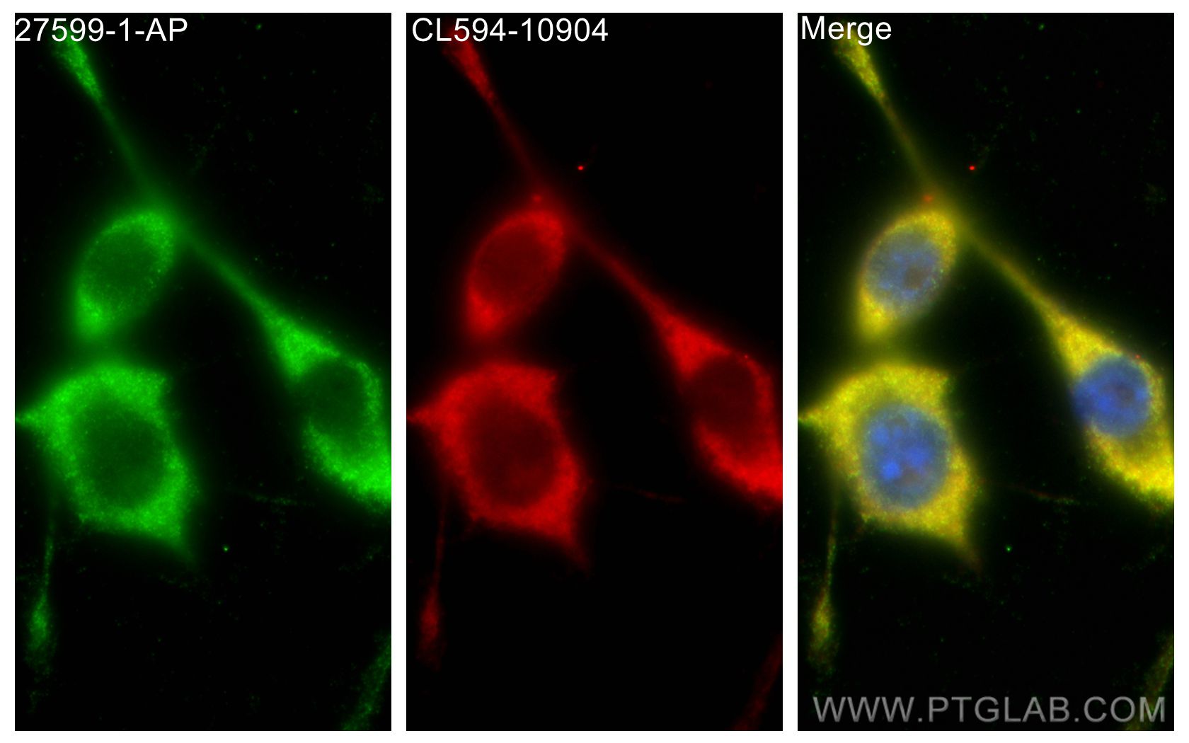 IF Staining of BV-2 using CL594-10904