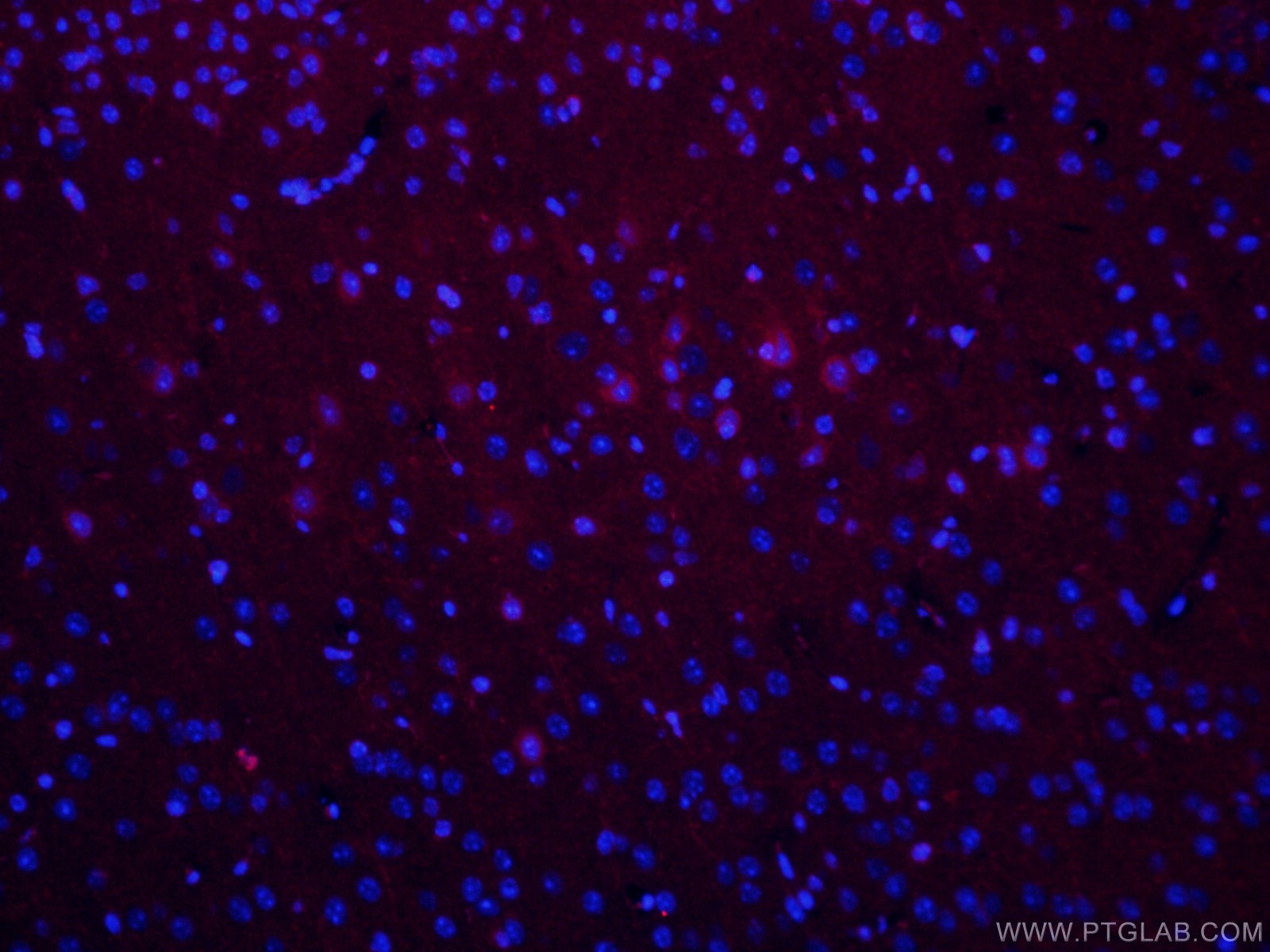 Immunofluorescence (IF) / fluorescent staining of mouse brain tissue using CoraLite® Plus 594-conjugated IBA1 Monoclonal anti (CL594-66827)