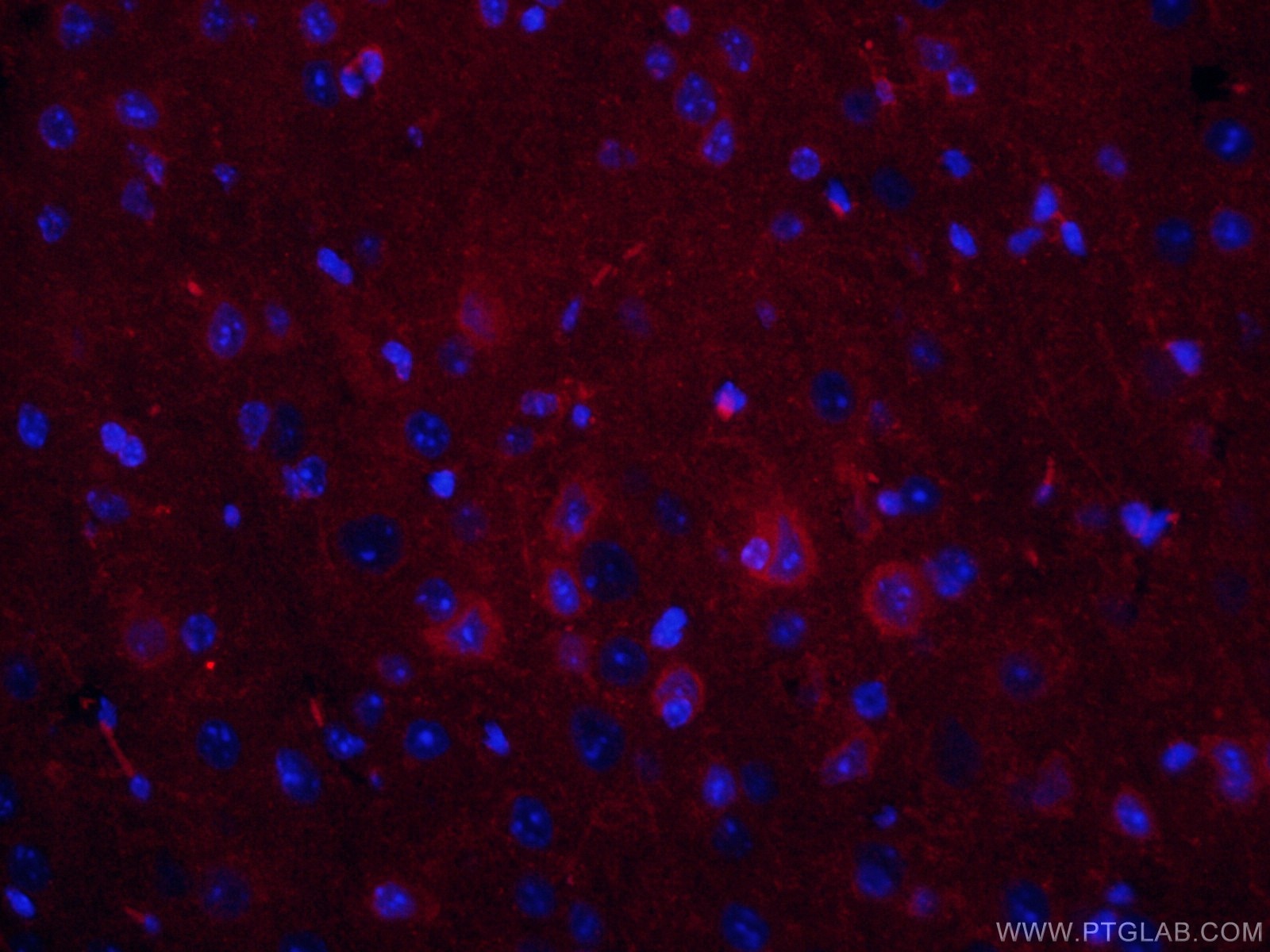 Immunofluorescence (IF) / fluorescent staining of mouse brain tissue using CoraLite® Plus 594-conjugated IBA1 Monoclonal anti (CL594-66827)