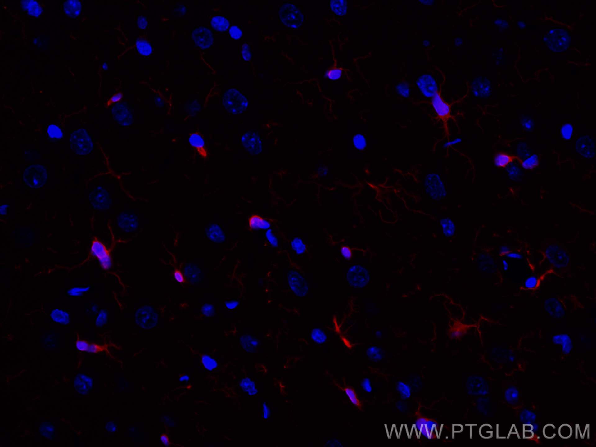 Immunofluorescence (IF) / fluorescent staining of rat brain tissue using CoraLite®594-conjugated IBA1 Recombinant antibody (CL594-81728)
