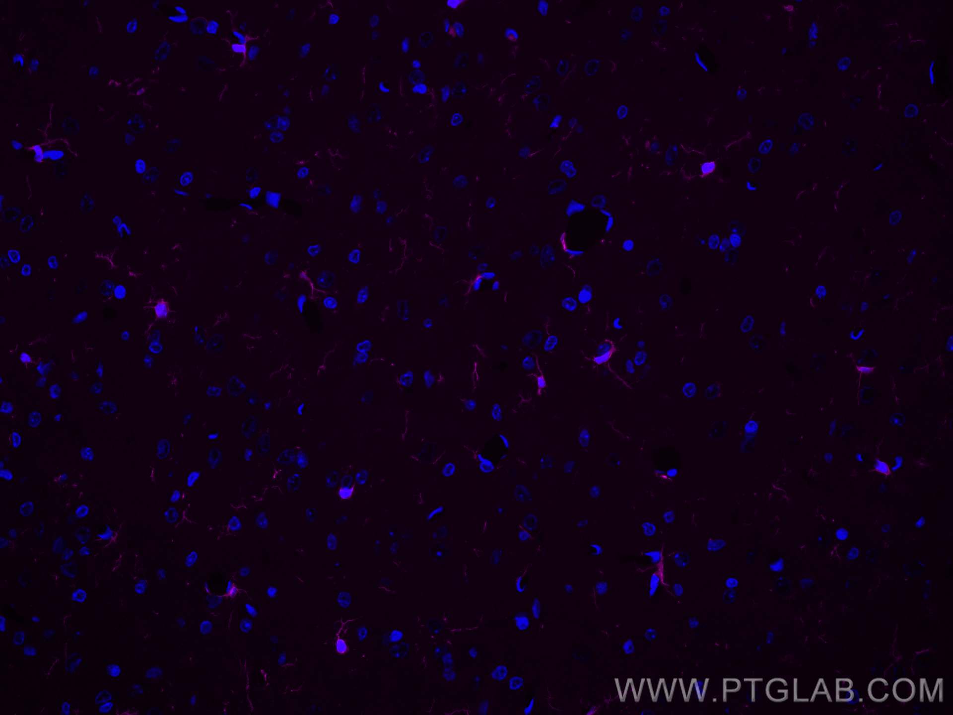 Immunofluorescence (IF) / fluorescent staining of rat brain tissue using CoraLite® Plus 647-conjugated IBA1 Recombinant ant (CL647-81728)