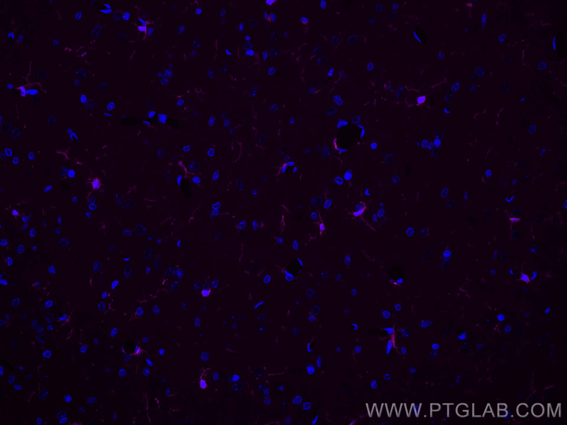 IF Staining of rat brain using CL647-81728