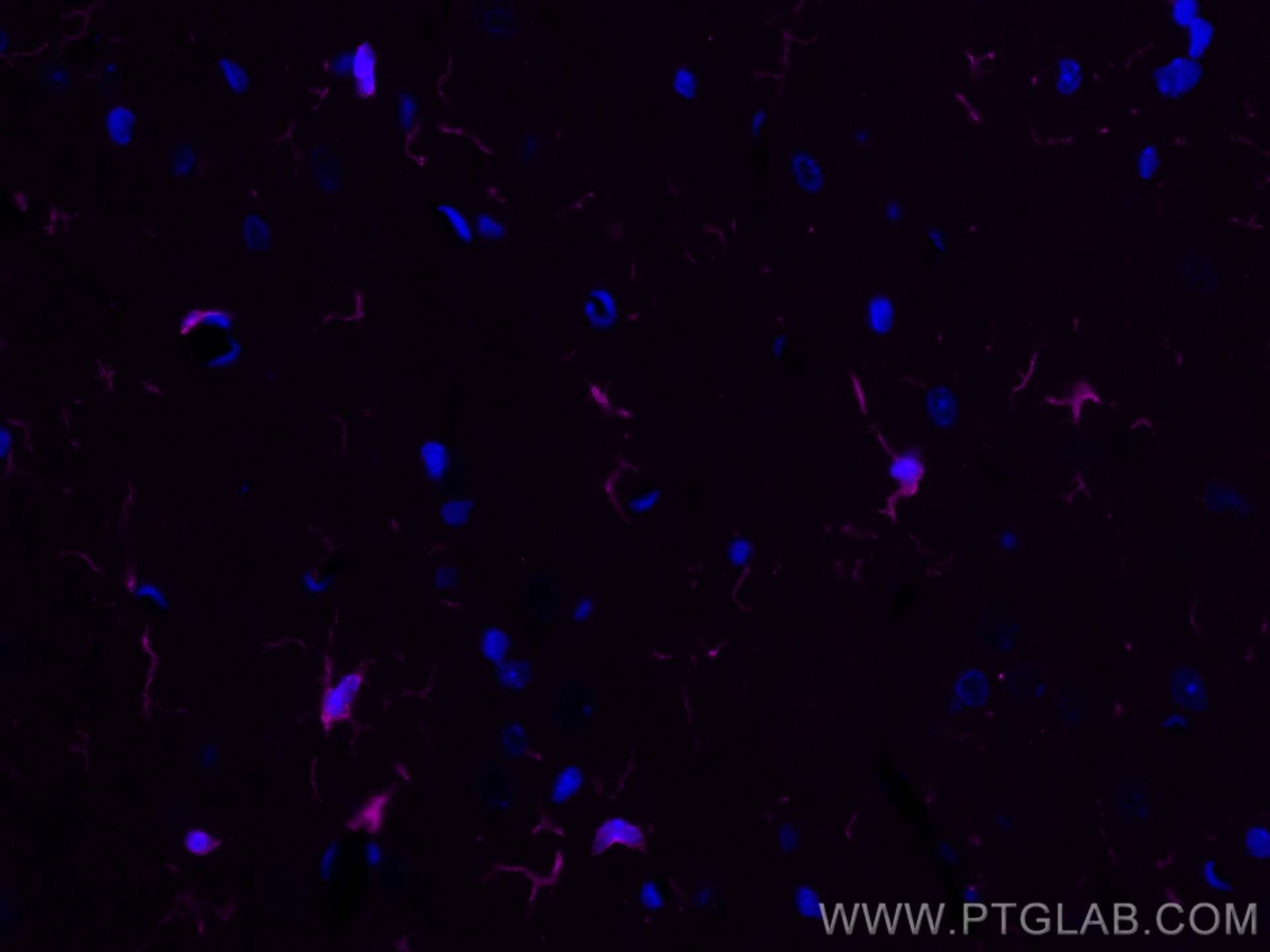 Immunofluorescence (IF) / fluorescent staining of rat brain tissue using CoraLite® Plus 647-conjugated IBA1 Recombinant ant (CL647-81728)