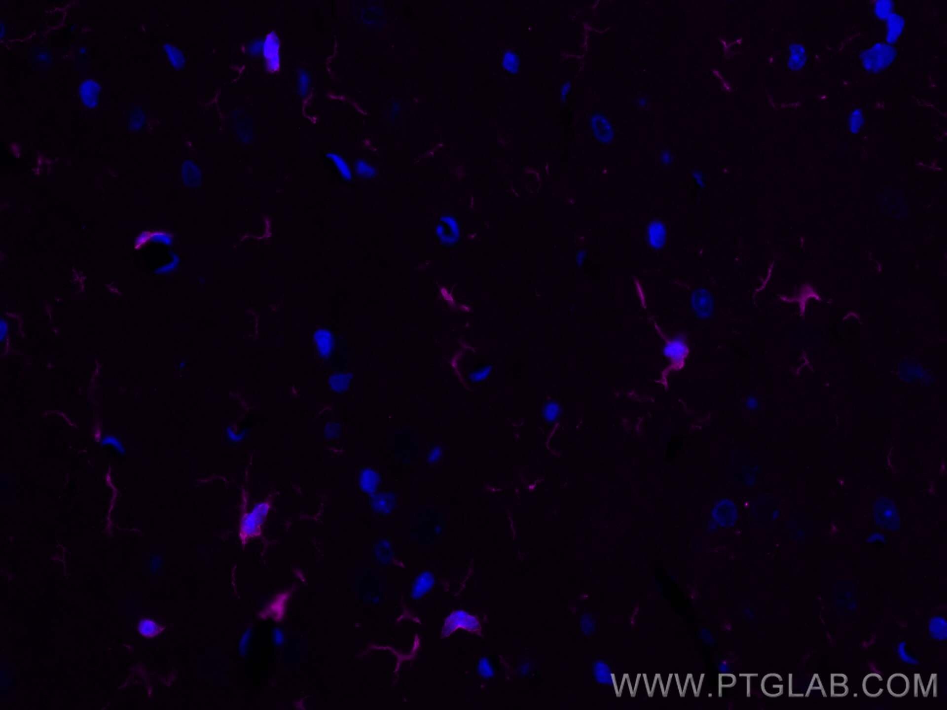 IF Staining of rat brain using CL647-81728