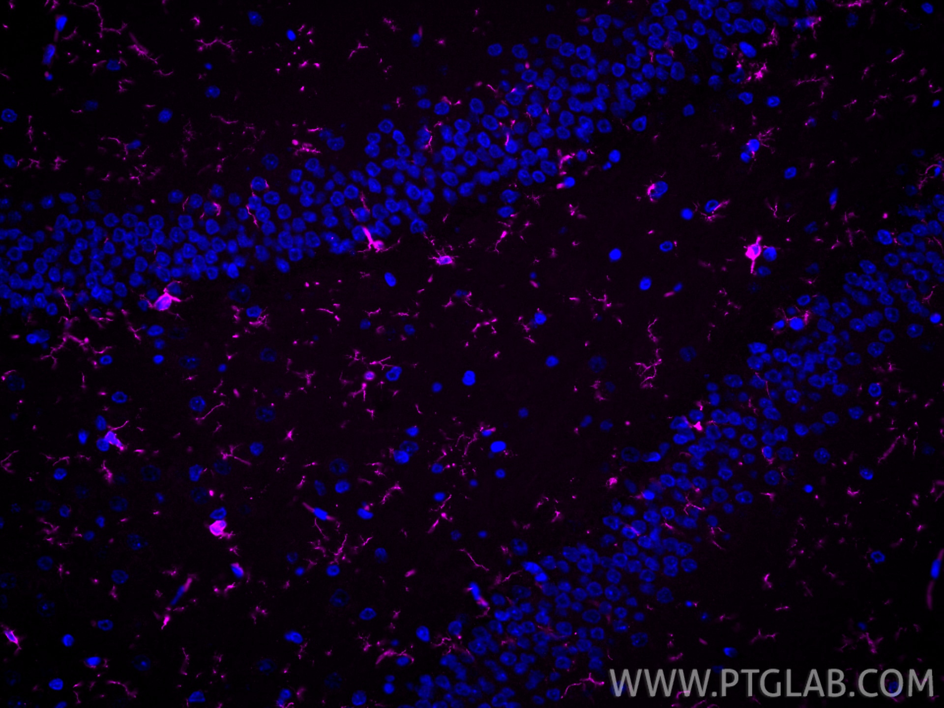 Immunofluorescence (IF) / fluorescent staining of rat brain tissue using CoraLite® Plus 647-conjugated IBA1 Recombinant ant (CL647-81728)