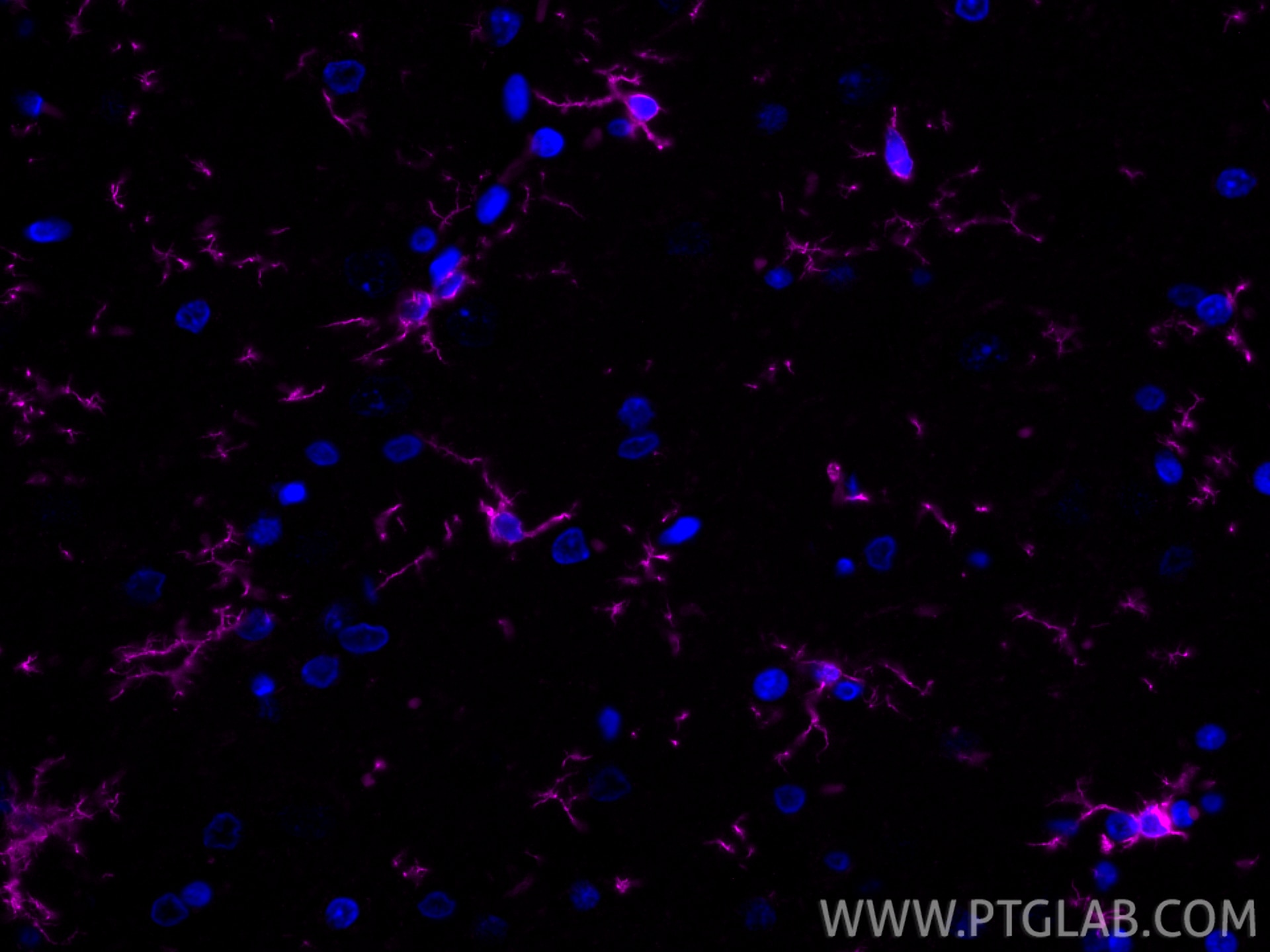 Immunofluorescence (IF) / fluorescent staining of rat brain tissue using CoraLite® Plus 647-conjugated IBA1 Recombinant ant (CL647-81728)