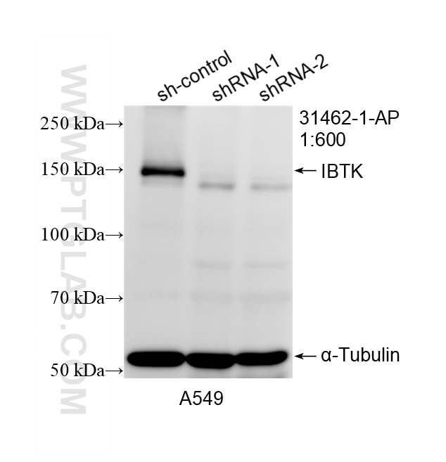 Western Blot (WB) analysis of A549 cells using IBTK Polyclonal antibody (31462-1-AP)