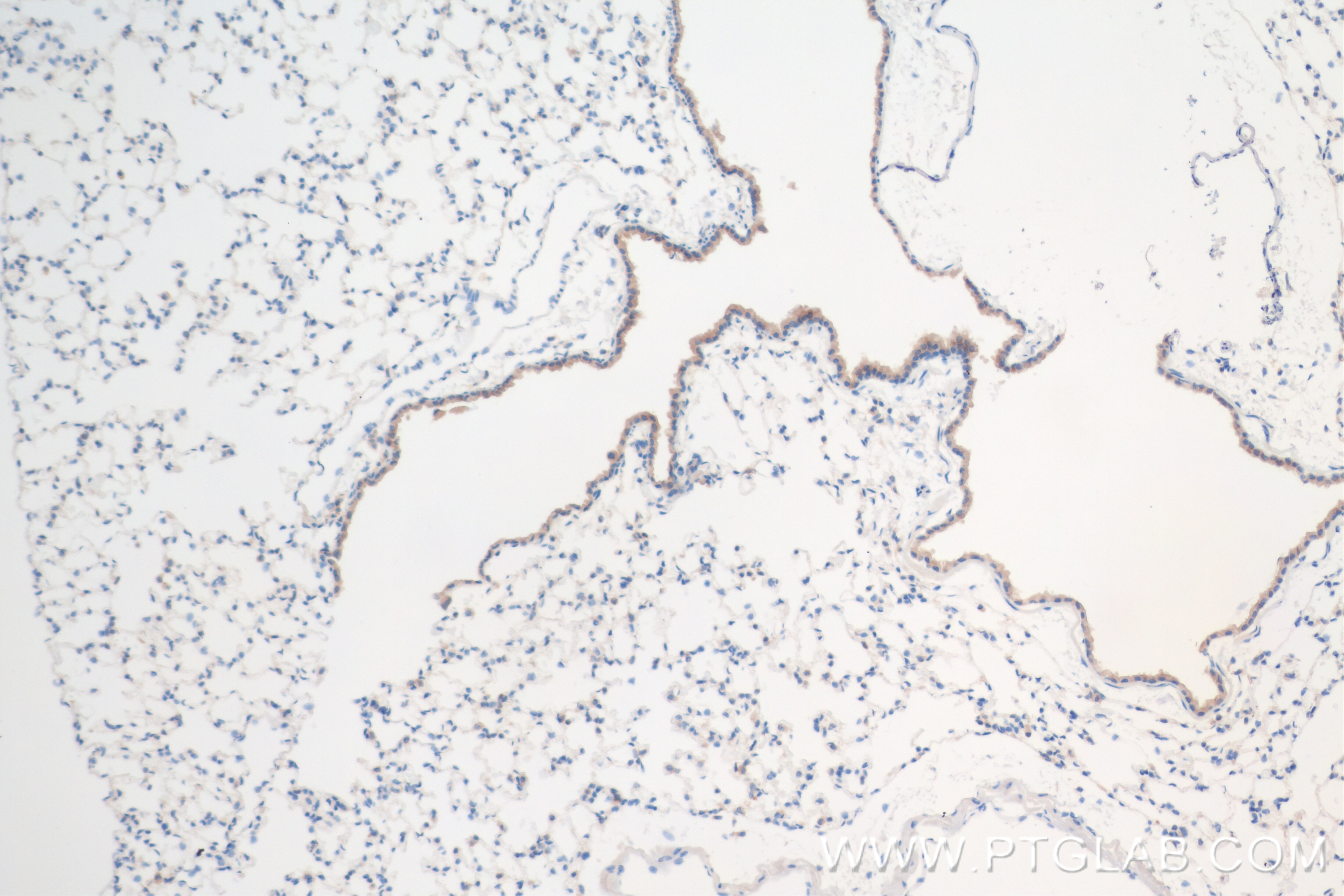 Immunohistochemistry (IHC) staining of mouse lung tissue using IBTK Recombinant antibody (84706-4-RR)