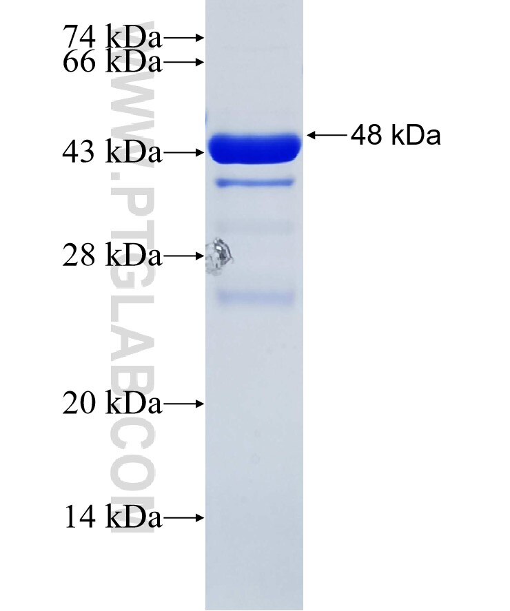 IBTK fusion protein Ag35421 SDS-PAGE