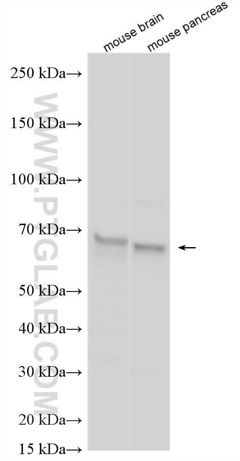 WB analysis using 10797-1-AP Western Blot (WB) analysis of various lysates using ICA1 Polyclonal antibody (10797-1-AP)
