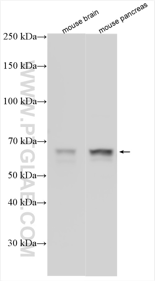 Western Blot (WB) analysis of various lysates using ICA1 Polyclonal antibody (10797-1-AP)