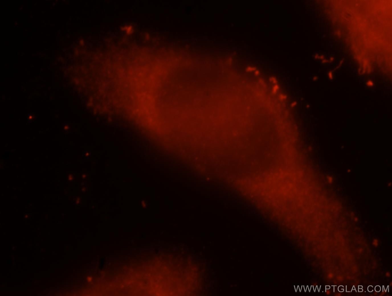 Immunofluorescence (IF) / fluorescent staining of MCF-7 cells using ICA1L Polyclonal antibody (15622-1-AP)
