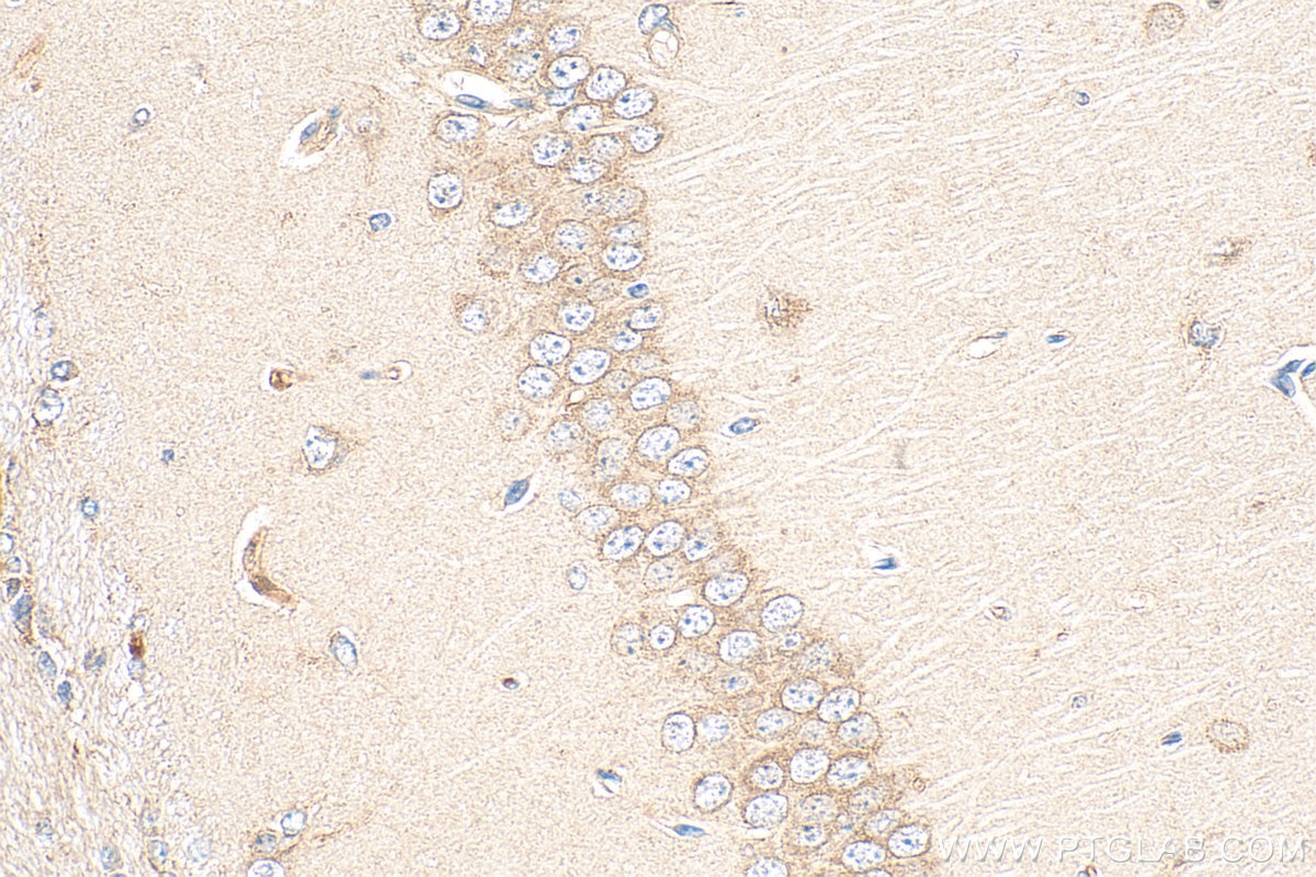 Immunohistochemistry (IHC) staining of mouse brain tissue using ICA1L Polyclonal antibody (18021-1-AP)