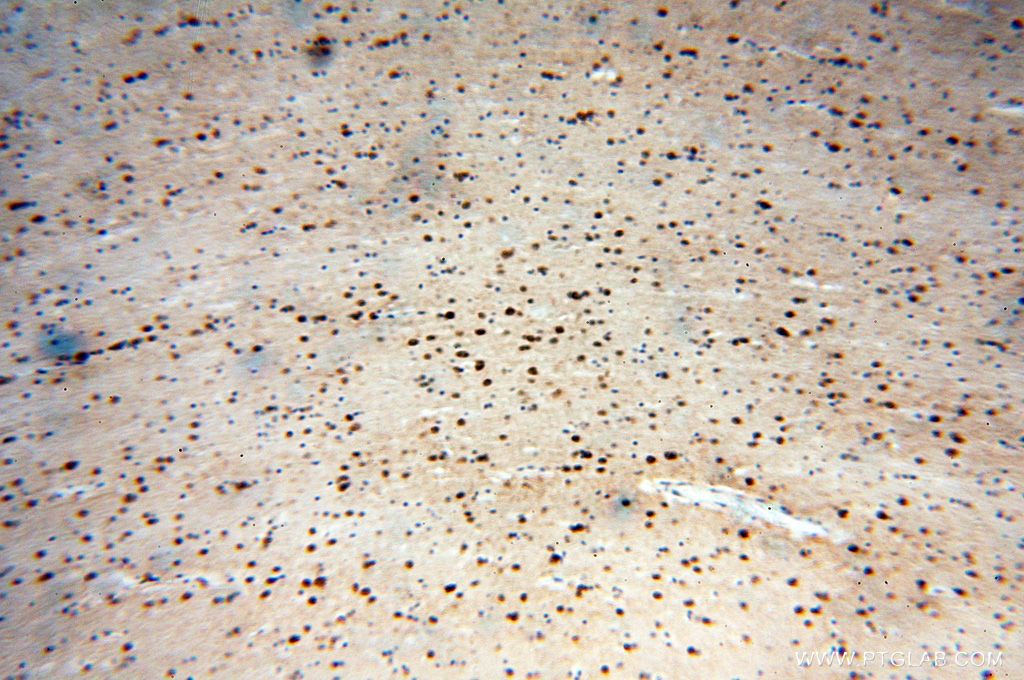 Immunohistochemistry (IHC) staining of human brain tissue using ICA1L Polyclonal antibody (18021-1-AP)