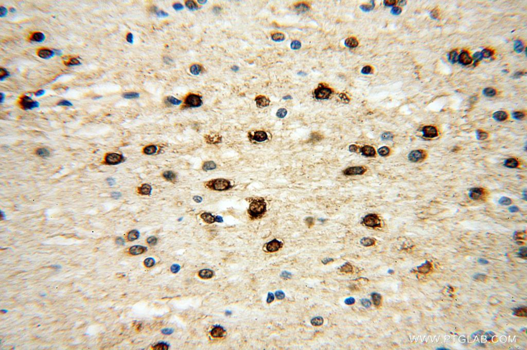 Immunohistochemistry (IHC) staining of human brain tissue using ICA1L Polyclonal antibody (18021-1-AP)
