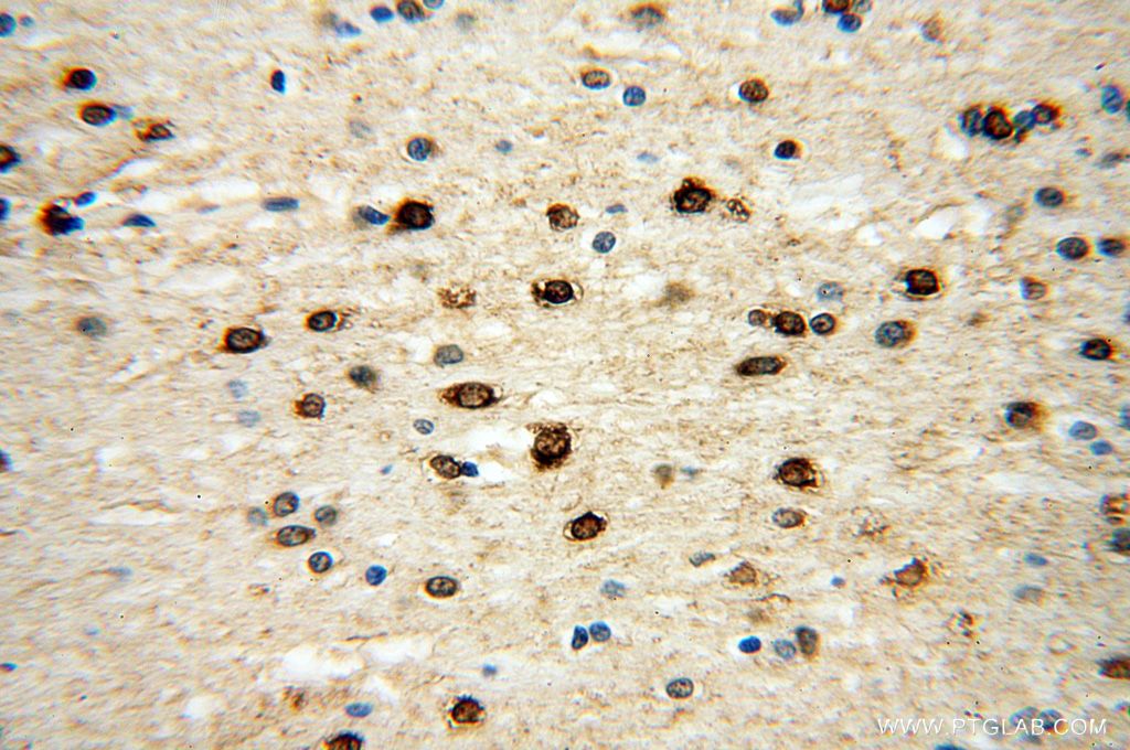 Immunohistochemistry (IHC) staining of human brain tissue using ICA1L Polyclonal antibody (18021-1-AP)