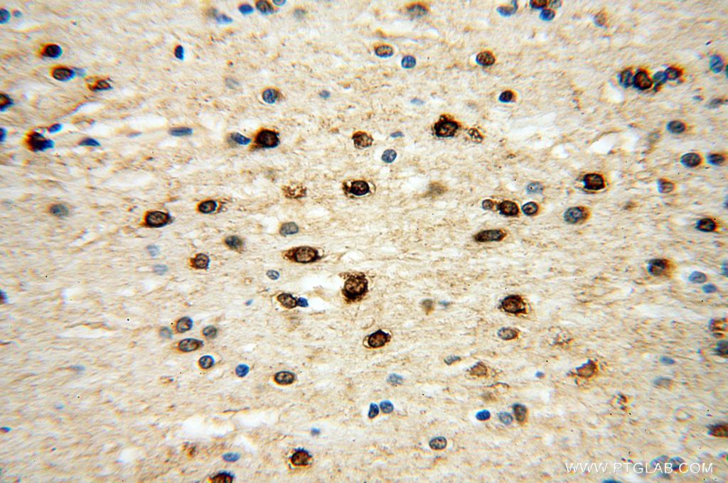 IHC staining of human brain using 18021-1-AP