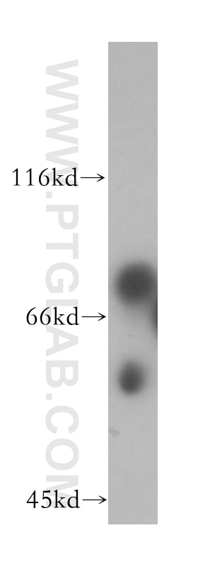 Western Blot (WB) analysis of mouse pancreas tissue using ICA1L Polyclonal antibody (18021-1-AP)