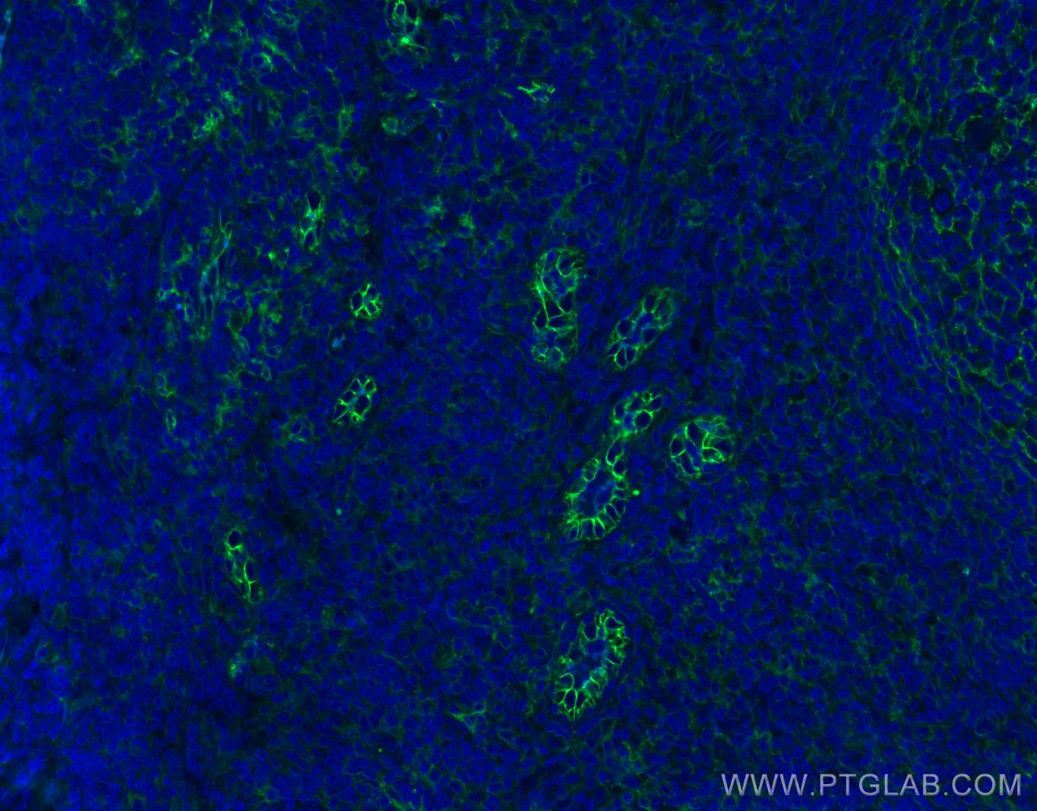Immunofluorescence (IF) / fluorescent staining of human tonsillitis tissue using ICAM-1/CD54 Polyclonal antibody (10831-1-AP)