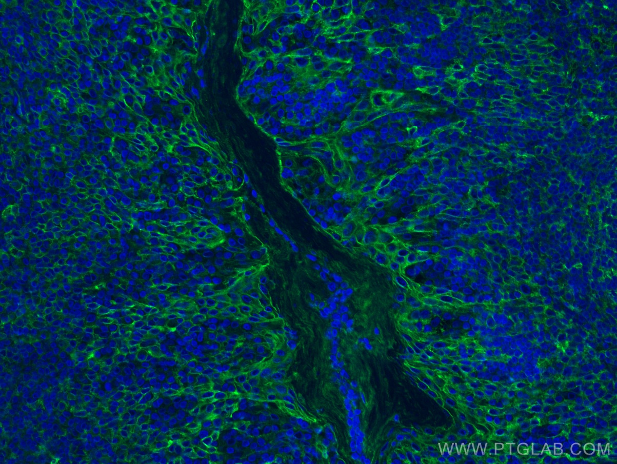 Immunofluorescence (IF) / fluorescent staining of human tonsillitis tissue using ICAM-1/CD54 Polyclonal antibody (10831-1-AP)