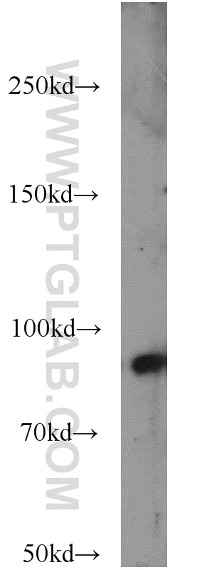 Western Blot (WB) analysis of L02 cells using ICAM-1 Polyclonal antibody (10831-1-AP)