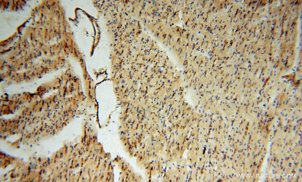 IHC staining of human heart using 15364-1-AP