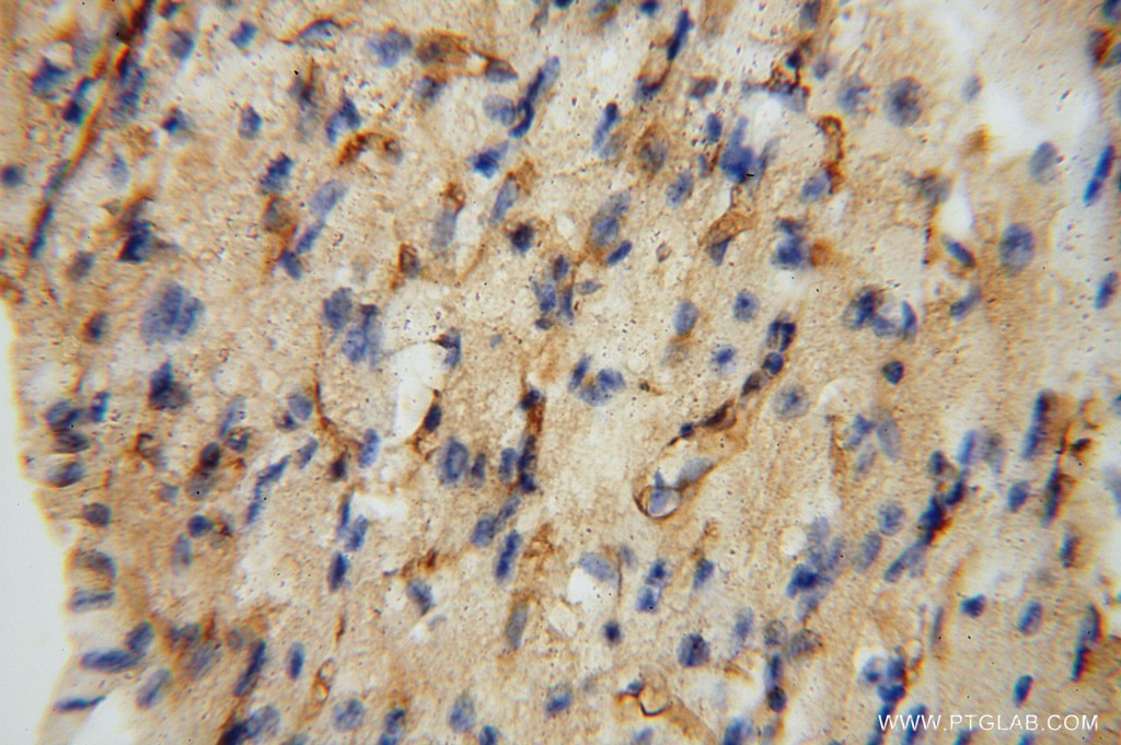 IHC staining of human heart using 15364-1-AP