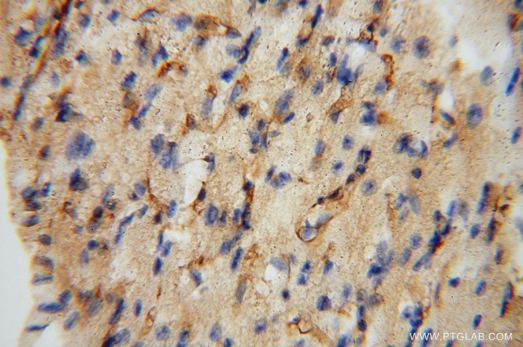 Immunohistochemistry (IHC) staining of human heart tissue using ICAM-1 Polyclonal antibody (15364-1-AP)