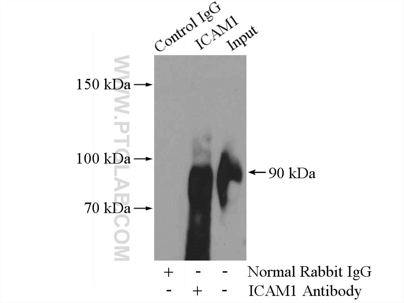 Immunoprecipitation (IP) experiment of Raji cells using ICAM-1 Polyclonal antibody (15364-1-AP)