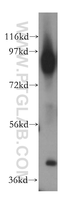 Western Blot (WB) analysis of human heart tissue using ICAM-1 Polyclonal antibody (15364-1-AP)