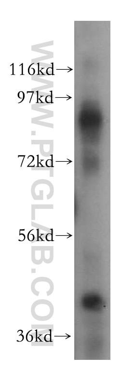 Western Blot (WB) analysis of Raji cells using ICAM-1 Polyclonal antibody (15364-1-AP)