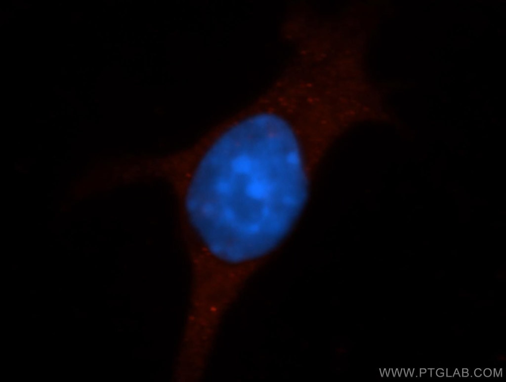 Immunofluorescence (IF) / fluorescent staining of 4T1 cells using ICAM-1 Polyclonal antibody (16174-1-AP)