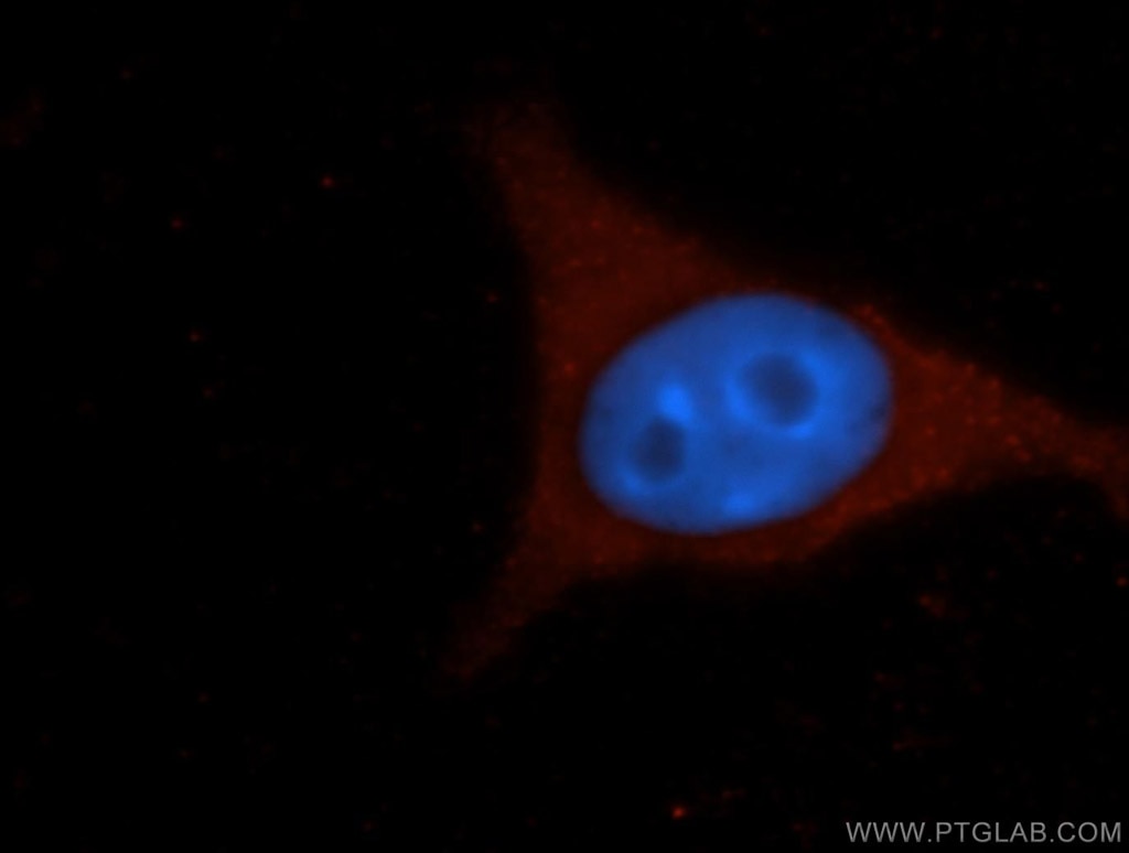 Immunofluorescence (IF) / fluorescent staining of 4T1 cells using ICAM-1 Polyclonal antibody (16174-1-AP)