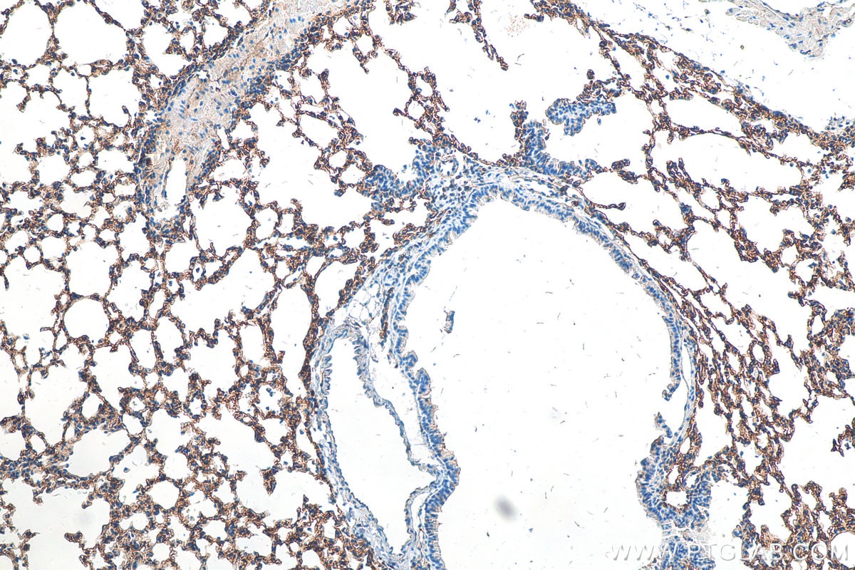 Immunohistochemistry (IHC) staining of mouse lung tissue using Icam-1 Polyclonal antibody (16174-1-AP)