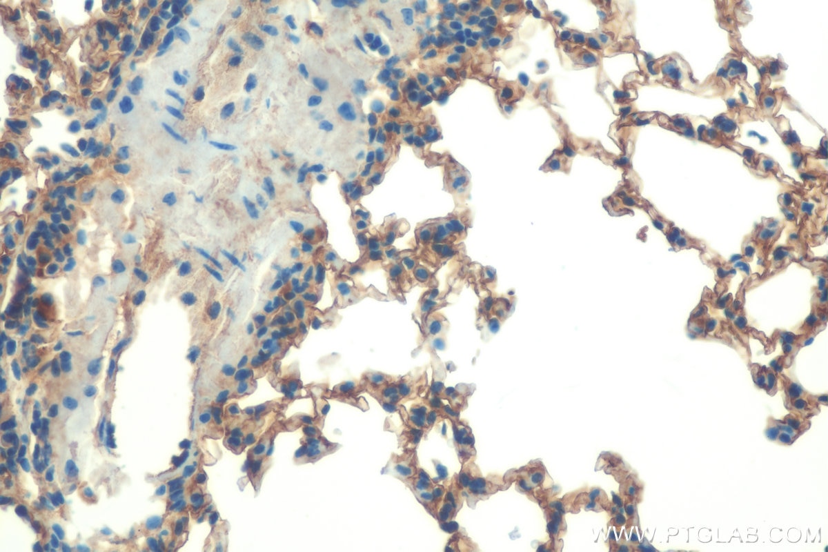 Immunohistochemistry (IHC) staining of mouse lung tissue using Icam-1 Polyclonal antibody (16174-1-AP)