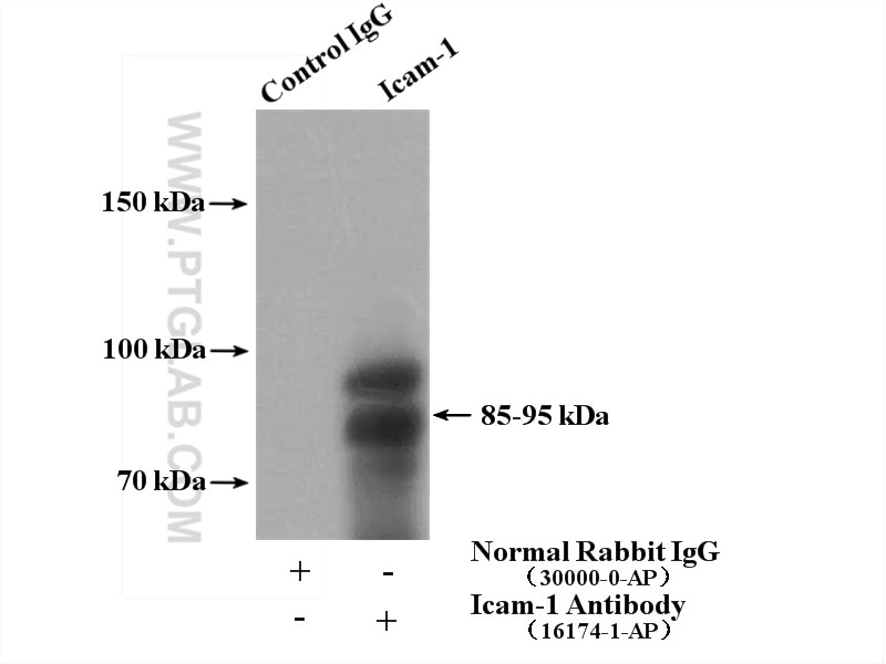 Immunoprecipitation (IP) experiment of 4T1 cells using Icam-1 Polyclonal antibody (16174-1-AP)