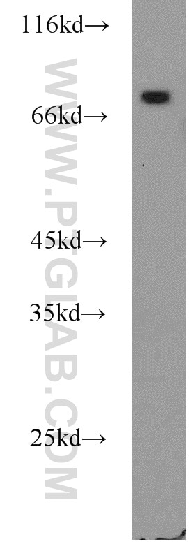 Western Blot (WB) analysis of rat heart tissue using ICAM-1 Polyclonal antibody (16174-1-AP)