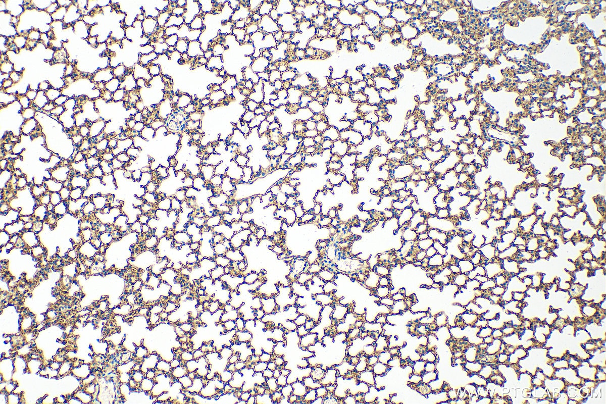 Immunohistochemistry (IHC) staining of mouse lung tissue using ICAM-1 Polyclonal antibody (31451-1-AP)